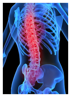 I-prac-spinalcordinjury